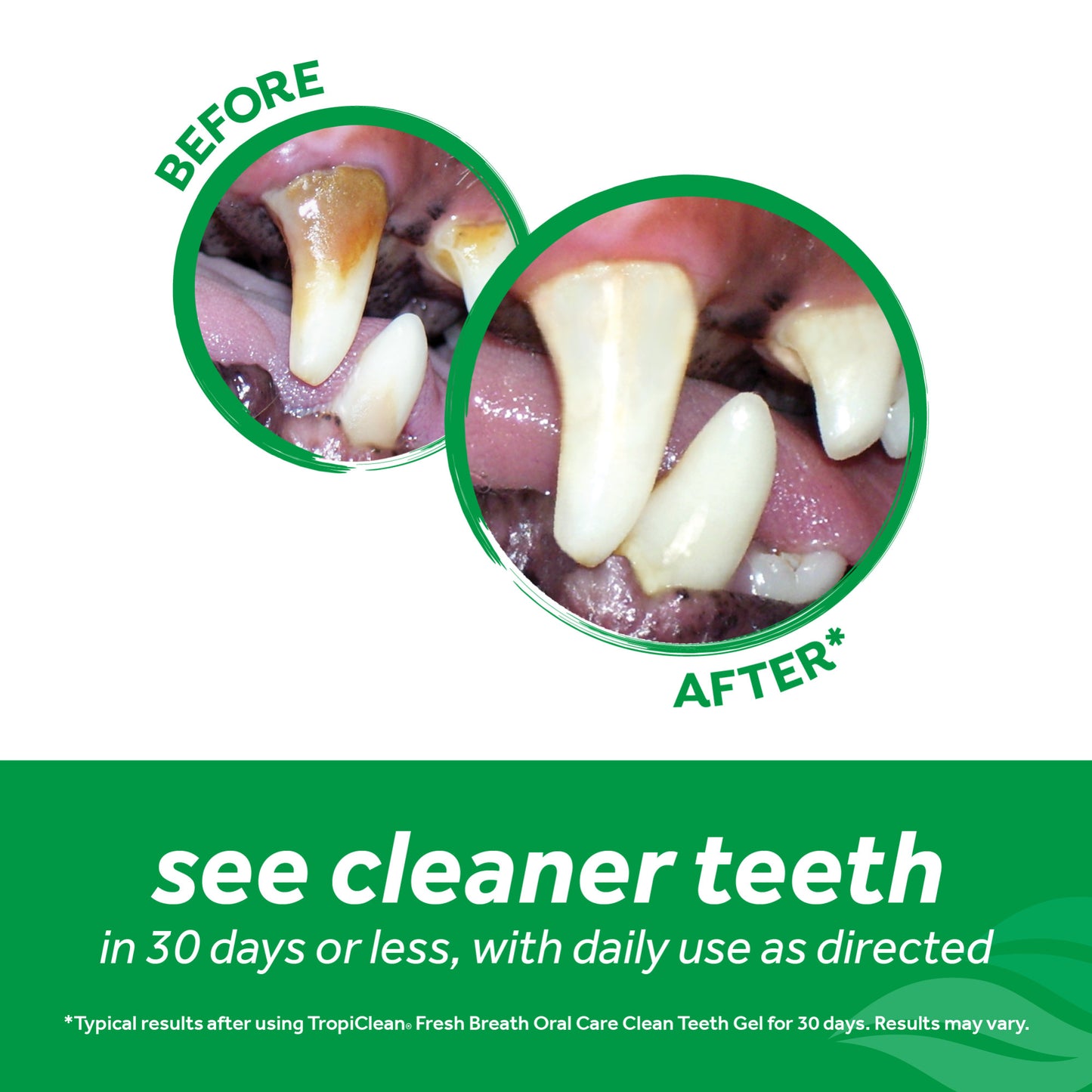 Dental Oral Gel